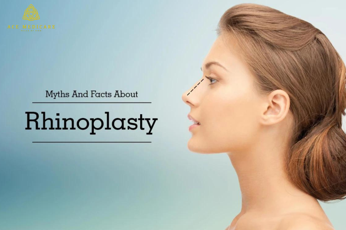 Debunking the Top Myths About Rhinoplasty